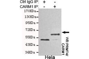 Immunoprecipitation analysis of Hela cell lysates using PRMT4/CARM1 mouse mAb. (CARM1 antibody)