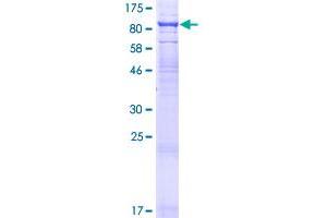 TCIRG1 Protein (AA 1-614) (GST tag)