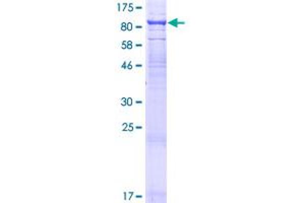 TCIRG1 Protein (AA 1-614) (GST tag)