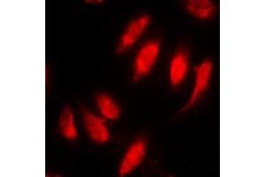 Immunofluorescent analysis of SMAD2 (pS467) staining in HeLa cells. (SMAD2 antibody  (C-Term, pSer467))