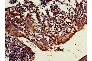 Immunohistochemistry of paraffin-embedded human tonsil tissue using ABIN7173455 at dilution of 1:100 (TRIM5 antibody  (AA 1-493))