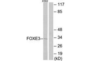 Western blot analysis of extracts from K562 cells, using FOXE3 Antibody. (FOXE3 antibody  (AA 81-130))