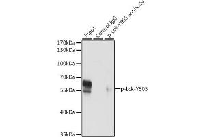 Immunoprecipitation analysis of 200 μg extracts of Jurkat cells, using 3 μg Phospho-Lck-Y505 pAb (ABIN3020027, ABIN3020028, ABIN3020029 and ABIN6225502). (LCK antibody  (pTyr505))