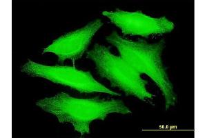 Immunofluorescence of monoclonal antibody to PAPOLB on HeLa cell. (PAPOLB antibody  (AA 1-637))