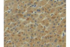 Detection of NRP1 in Human Liver Tissue using Polyclonal Antibody to Neuropilin 1 (NRP1)