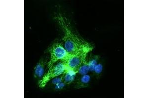 ICC/IF analysis of KRT19 in HepG2 cells line, stained with DAPI (Blue) for nucleus staining and monoclonal anti-human HepG2 antibody (1:100) with goat anti-mouse IgG-Alexa fluor 488 conjugate (Green). (Cytokeratin 19 antibody  (AA 1-400))