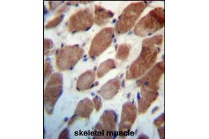 TRIM54 Antibody (N-term) (ABIN657215 and ABIN2846323) immunohistochemistry analysis in formalin fixed and paraffin embedded human skeletal muscle followed by peroxidase conjugation of the secondary antibody and DAB staining. (TRIM54 antibody  (N-Term))