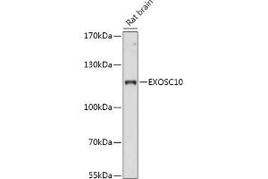 Western blot analysis of extracts of Rat brain, using EXOSC10 antibody (ABIN7267062) at 1:1000 dilution. (EXOSC10 antibody  (AA 586-885))