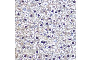 Immunohistochemistry (IHC) image for anti-Transketolase (TKT) (AA 1-280) antibody (ABIN6149201)