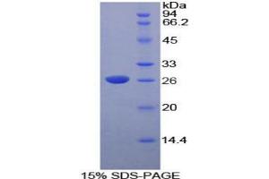 SDS-PAGE analysis of Rat DNASE1L2 Protein. (DNASE1L2 Protein)