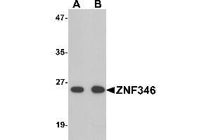 Western blot analysis of TRIP6 in EL4 cell lysate with TRIP6 antibody at 1 µg/mL. (ZNF346 antibody  (N-Term))