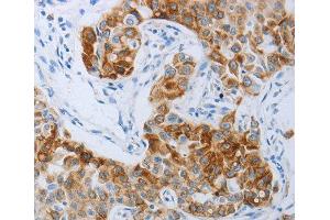 Immunohistochemistry (IHC) image for anti-Pyrimidinergic Receptor P2Y, G-Protein Coupled, 4 (P2RY4) (AA 286-365) antibody (ABIN3017282) (P2RY4 antibody  (AA 286-365))