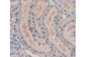 IHC-P analysis of Rat Tissue, with DAB staining. (Androgen Receptor antibody  (AA 765-902))