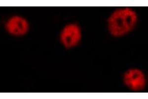 ABIN6269304 staining HuvEc by IF/ICC. (FOXO4 antibody  (Internal Region))