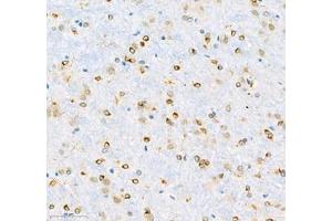 Immunohistochemistry of paraffin embedded rat brain using MAP7 (ABIN7074621) at dilution of 1:600 (300x lens) (MAP7 antibody)