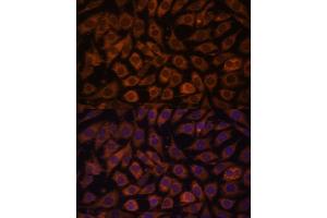 Immunofluorescence (IF) image for anti-Toll-Like Receptor 3 (TLR3) (AA 464-647) antibody (ABIN6149219)