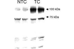 Human AGGF1 detected in HT1080 non-transfected cell lysate (NTC) and HT1080 transfected cell lysate (TC) using AGGF1 polyclonal antibody .