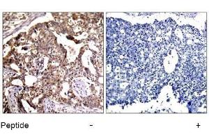 Image no. 1 for anti-Mitogen-Activated Protein Kinase Kinase 4 (MAP2K4) (Ser80) antibody (ABIN197324) (MAP2K4 antibody  (Ser80))