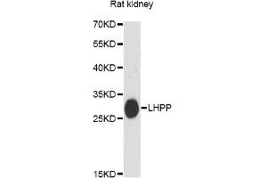 Western blot analysis of extracts of rat kidney, using LHPP antibody (ABIN6292546) at 1:3000 dilution. (LHPP antibody)