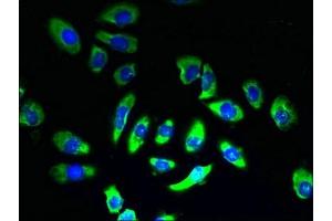 Immunofluorescent analysis of A549 cells using ABIN7170015 at dilution of 1:100 and Alexa Fluor 488-congugated AffiniPure Goat Anti-Rabbit IgG(H+L) (SLC5A2 antibody  (AA 335-422))