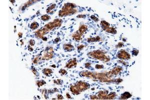 Immunohistochemical staining of paraffin-embedded Human breast tissue using anti-AK5 mouse monoclonal antibody.