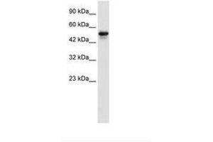 Image no. 1 for anti-SET Domain Containing 4 (SETD4) (AA 342-391) antibody (ABIN6735922) (SETD4 antibody  (AA 342-391))