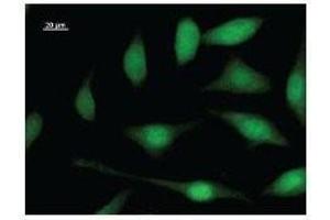 Immunostaining analysis in HeLa cells. (E2F5 antibody)