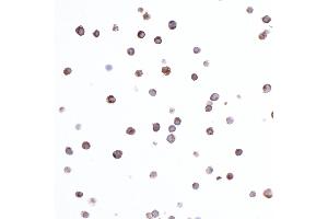 Immunocytochemistry (ICC) image for anti-HLA-DR-gamma (CD74) antibody (ABIN7449435) (CD74 antibody)
