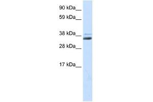 SFRP1 antibody (20R-1319) used at 0. (SFRP1 antibody  (Middle Region))