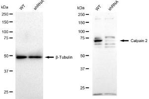 Western blotting analysis using Calpain 2 antibody (ABIN7797847). (Recombinant Calpain 2 antibody)