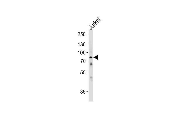 HSPA6 antibody  (C-Term)