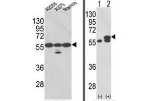 (LEFT) Western blot analysis of PDIA3 Antibody (Center) in A2058, A375, Ramos cell line lysates (35ug/lane). (PDIA3 antibody  (Middle Region))