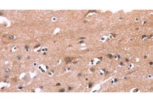 Immunohistochemistry of paraffin-embedded Human brain tissue using PIP5K1B Polyclonal Antibody at dilution 1:30 (PIP5K1B antibody)