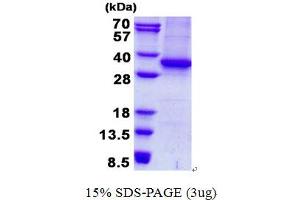 Image no. 1 for Acetylserotonin O-Methyltransferase (ASMT) protein (His tag) (ABIN5780841)