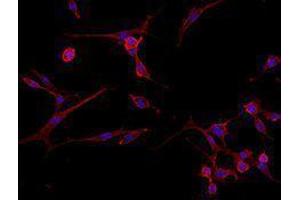 Immunofluorescence (IF) image for Goat anti-Rat IgG antibody (Alexa Fluor 594) (ABIN2667001) (Goat anti-Rat IgG Antibody (Alexa Fluor 594))