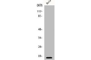 Western Blot analysis of HeLa cells using p16 Polyclonal Antibody (CDKN2A antibody  (N-Term))