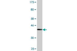 Western Blot detection against Immunogen (36. (SSH1 antibody  (AA 752-849))