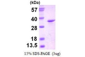 Image no. 1 for Eukaryotic Translation Initiation Factor 4H (EIF4H) protein (His tag) (ABIN1098293)