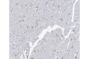 Immunohistochemistry (IHC) image for anti-Neuregulin 1 (NRG1) (N-Term) antibody (ABIN6254897)