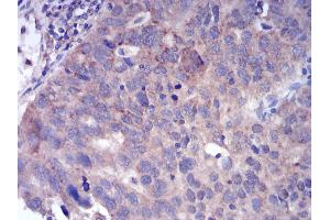 Immunohistochemistry (IHC) image for anti-Fibroblast Growth Factor Receptor 3 (FGFR3) (AA 529-694) antibody (ABIN5542298)