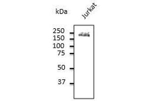 Endogenous CD45 detected with at 1/500 dilution, Iysate at 100 µg per Iane and rabbit polyclonal to goat lgG (HRP) at 1/10,000 dilution. (CD45 antibody  (C-Term))