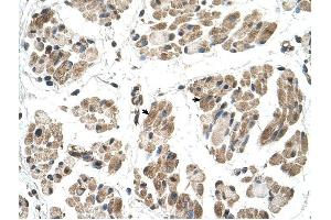 FKTN antibody was used for immunohistochemistry at a concentration of 4-8 ug/ml to stain Skeletal muscle cells (arrows) in Human Muscle. (Fukutin antibody  (N-Term))