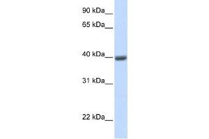 Western Blotting (WB) image for anti-Melanoma Antigen Family A, 1 (Directs Expression of Antigen MZ2-E) (MAGEA1) antibody (ABIN2458988) (MAGEA1 antibody)