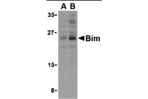 Western Blotting (WB) image for anti-BCL2-Like 11 (Apoptosis Facilitator) (BCL2L11) (Middle Region 2) antibody (ABIN1031197) (BIM antibody  (Middle Region 2))