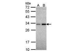 Image no. 1 for anti-NAD(P)H Dehydrogenase, Quinone 1 (NQO1) (AA 67-271) antibody (ABIN467603) (NQO1 antibody  (AA 67-271))
