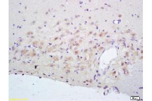 Formalin-fixed and paraffin embedded rat brain labeled with Rabbit Anti NR2A/NMDAR2A Polyclonal Antibody, Unconjugated (ABIN747353) at 1:200 followed by conjugation to the secondary antibody and DAB staining