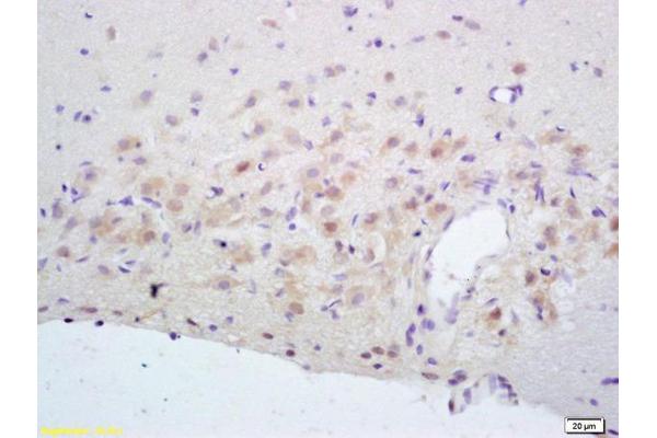 NMDAR2A anticorps  (AA 851-950)