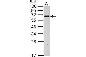 WB Image Sample (30 ug of whole cell lysate) A: BCL-1 12% SDS PAGE antibody diluted at 1:1000 (C4BPB antibody)