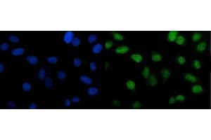 IF analysis of PTBP2 using anti-PTBP2 antibody (ABIN7599454). (PTBP2 antibody  (AA 1-504))
