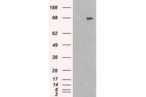 HEK293T cells were transfected with the pCMV6-ENTRY control (Left lane) or pCMV6-ENTRY APP (Right lane) cDNA for 48 hrs and lysed. (APP antibody)